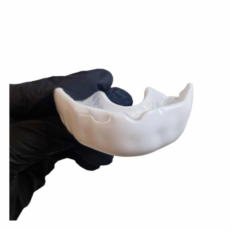 Protège-dents Dent-Guard