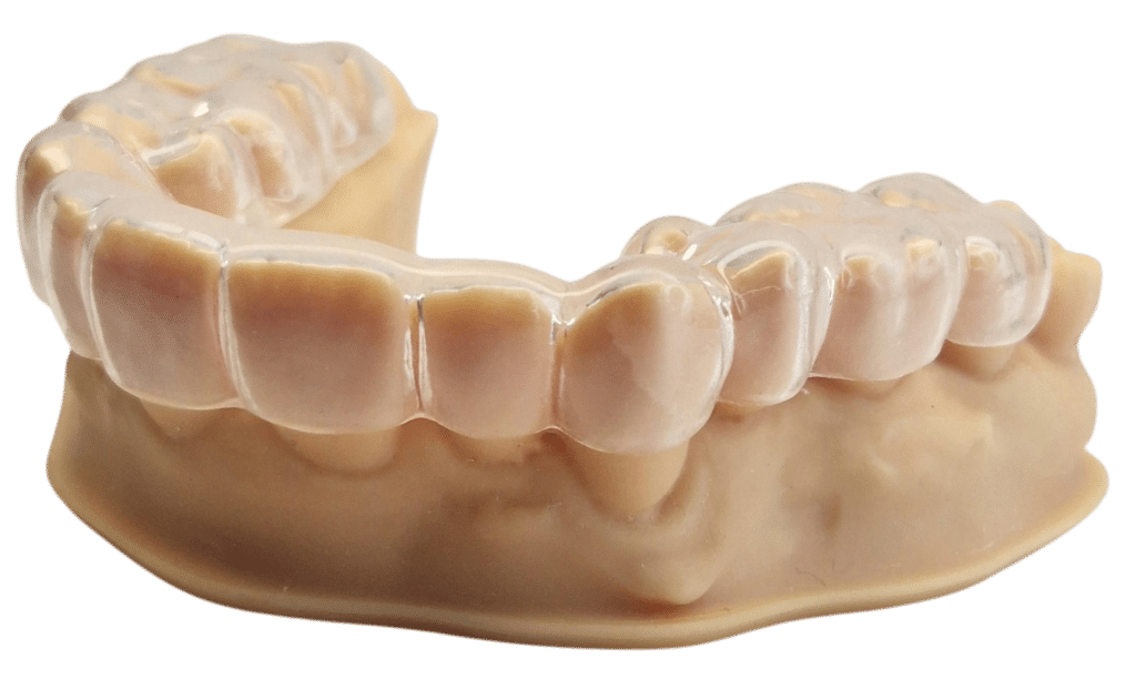 Gebitsmodel